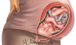 Гипертонус матки при беременности 1 триместр лечение в домашних условиях